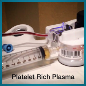 Is Platelet-Rich Plasma an Effective Healing Therapy?